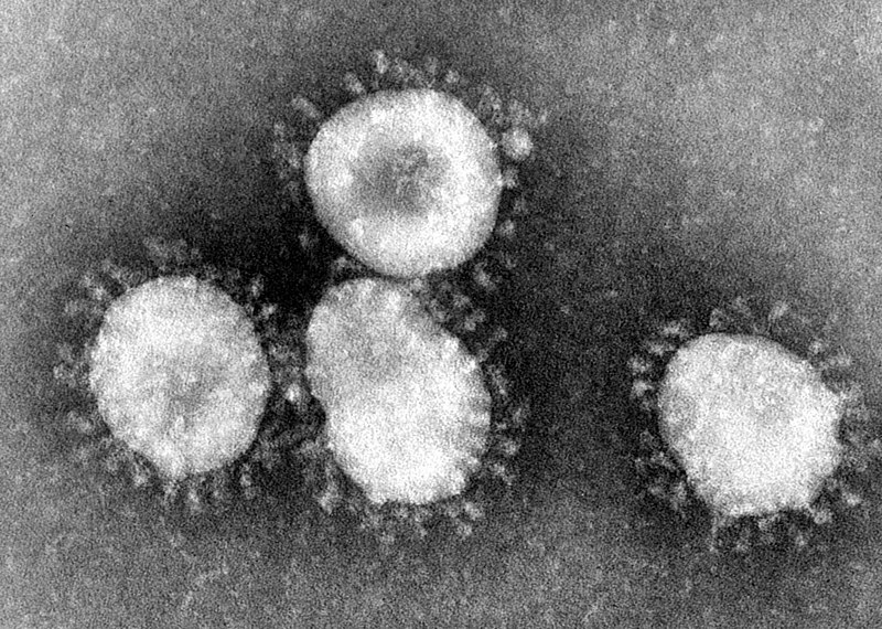 Coronavirussen zijn een groep virussen die een halo of kroonachtig (corona) uiterlijk hebben wanneer ze onder een elektronenmicroscoop worden bekeken.