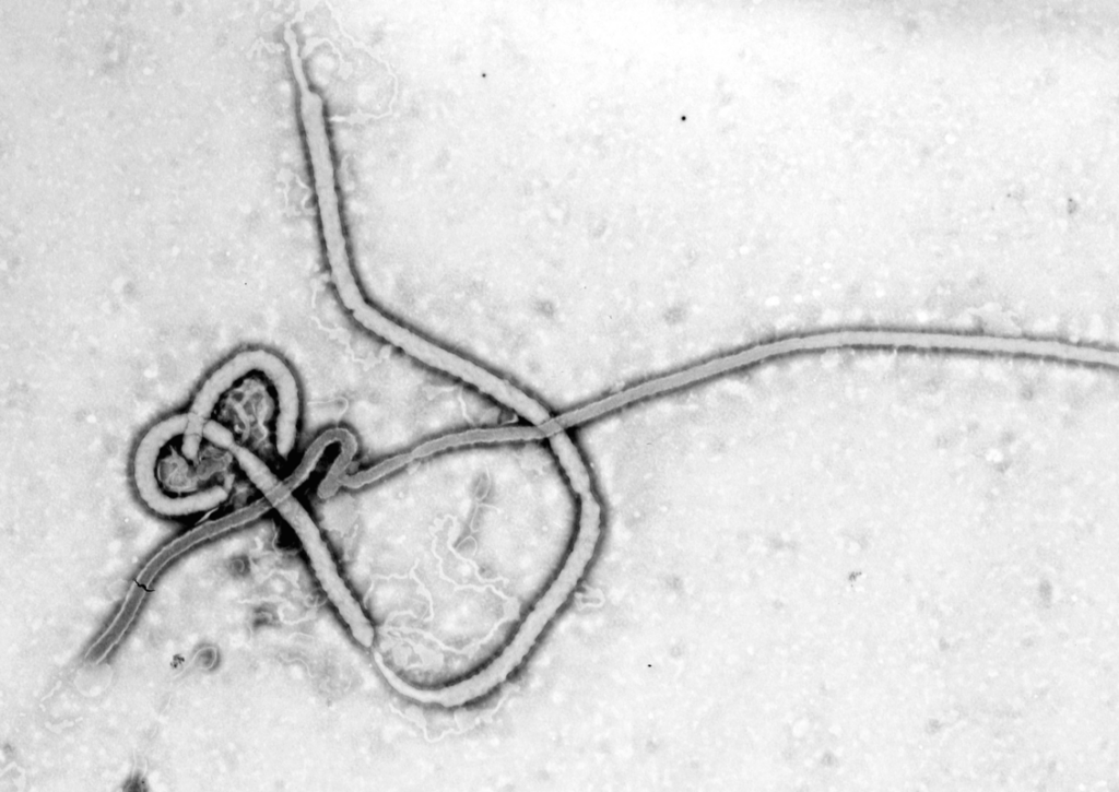 het ebolavirus is enorm klein en sliertvormig