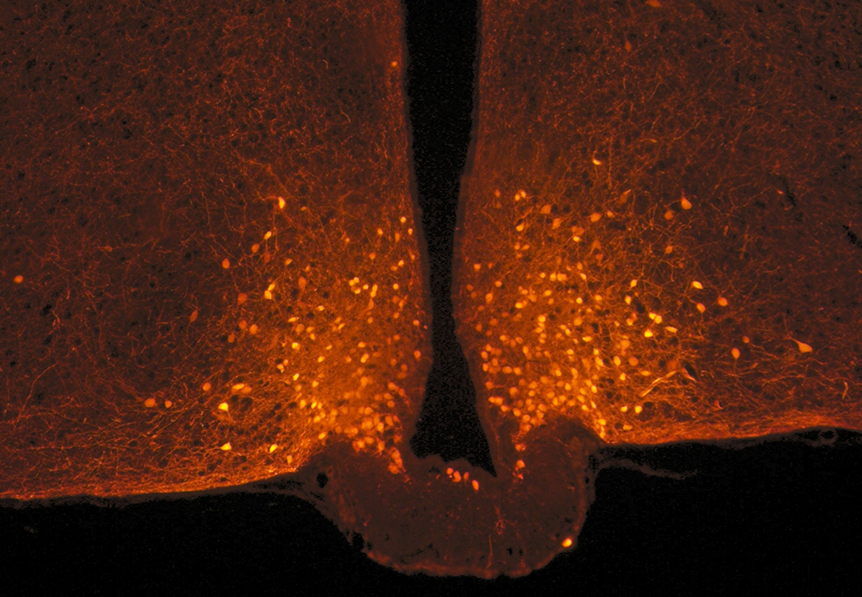 POMC-neuronen (oranje puntjes) bevinden zich in de hypothalamus. Zichtbaar gemaakt onder een confocale lasermicroscoop